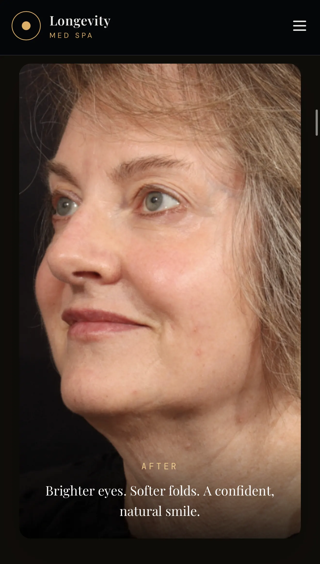 After combination treatment - oblique view
