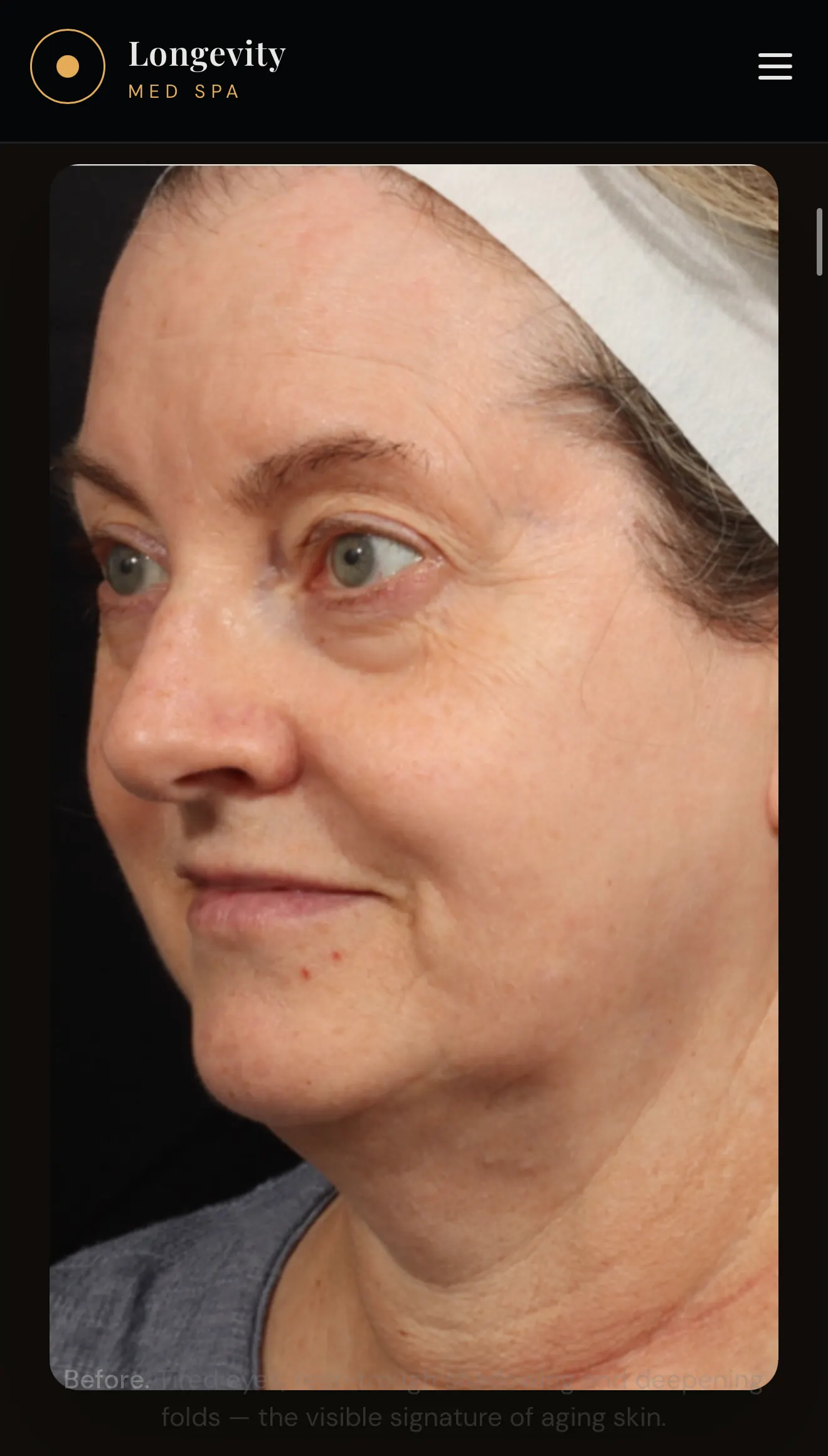 Before treatment - oblique view