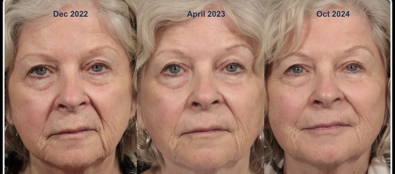 Patient progression over 2 years