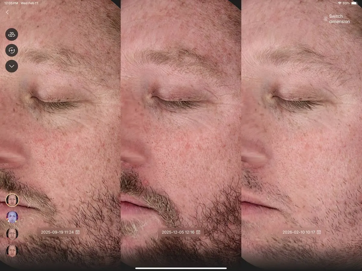 Patient skin progression across three clinical timepoints