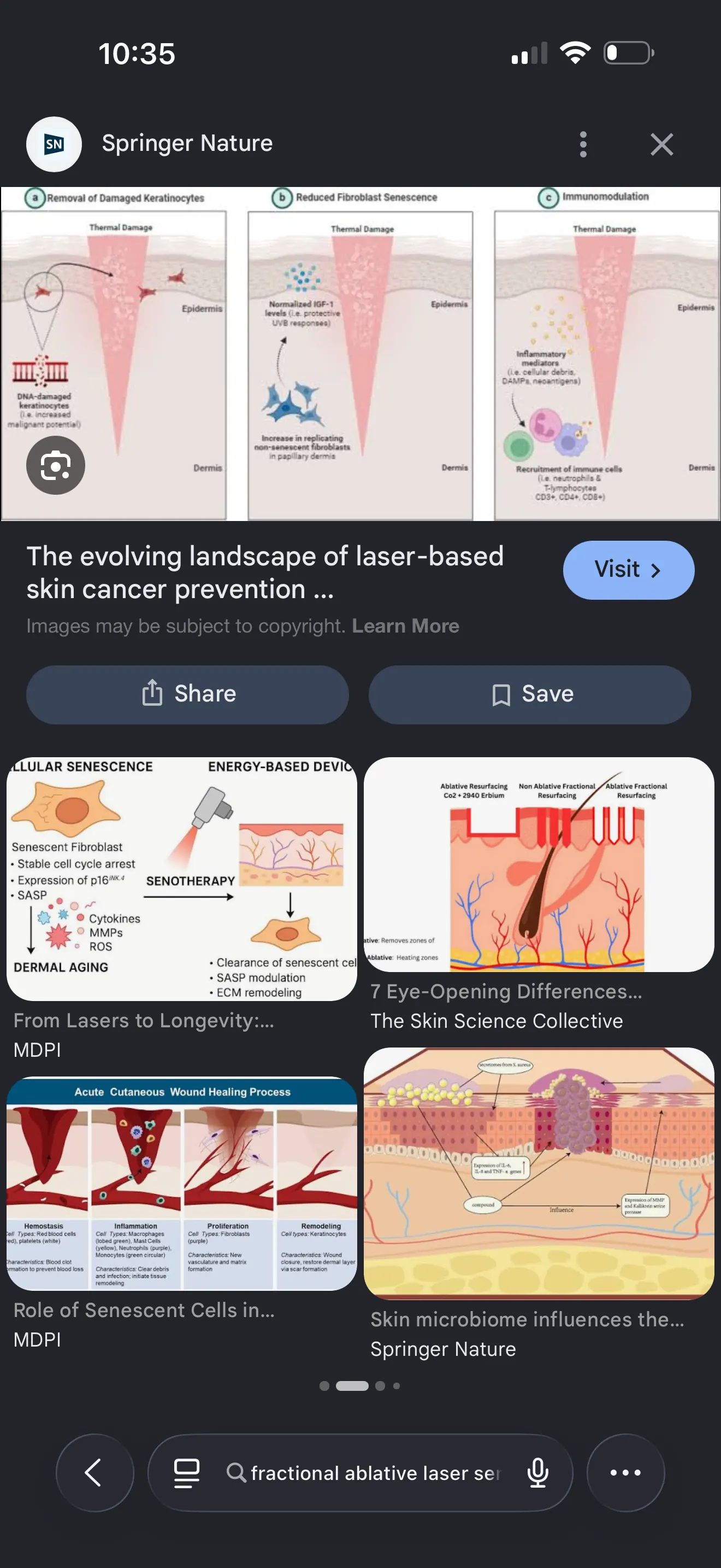 Springer Nature review: three mechanisms of fractional laser — removal of DNA-damaged keratinocytes, dermal remodeling, immune normalization