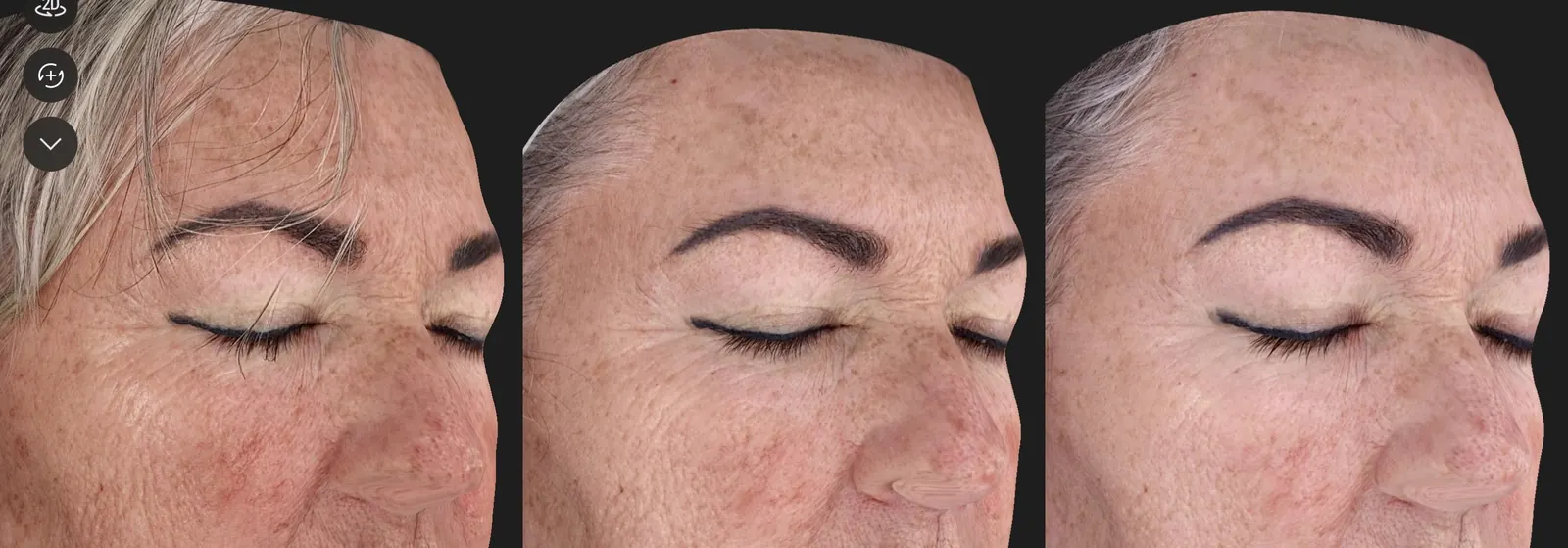 Skin progression over time