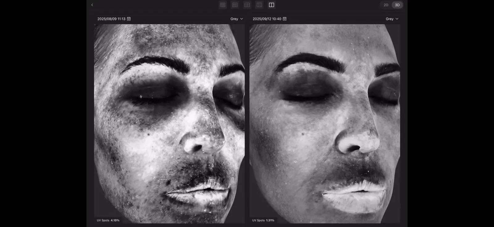 UV spots before and after